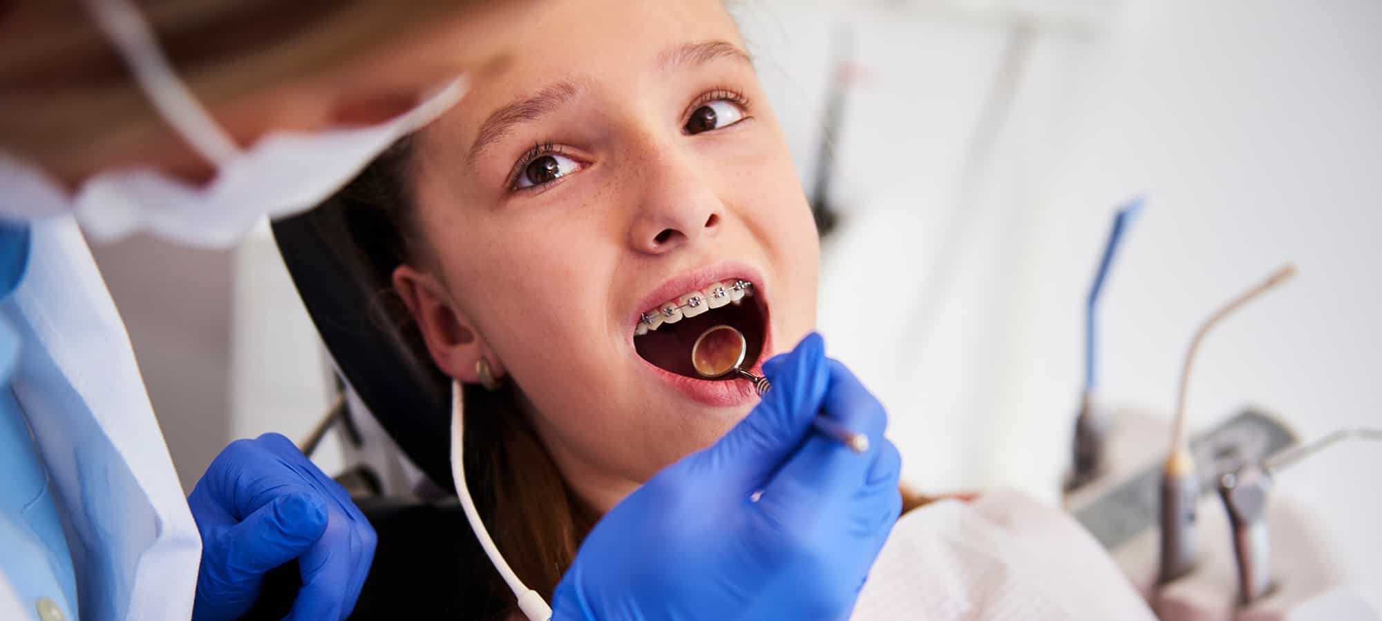 When Should Your Child Visit the Orthodontist?